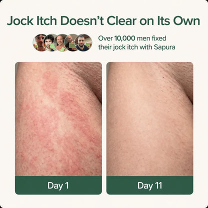 Sapura Anti-fungal Soap