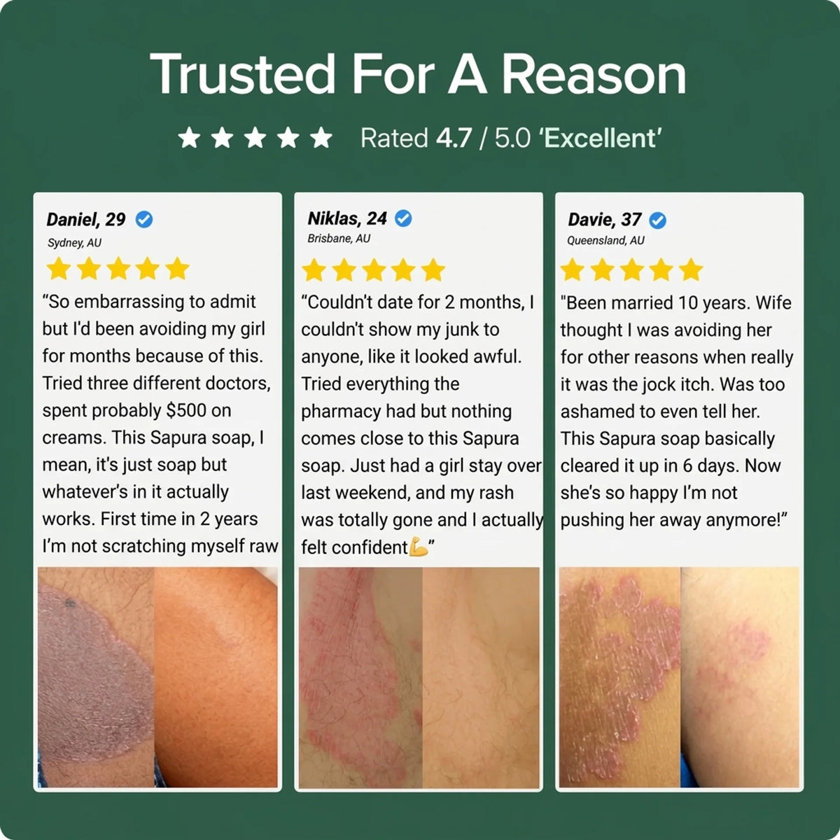 Sapura Anti-fungal Soap